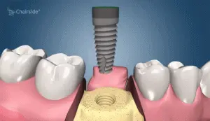 Dentista cerca de mí, dentista cerca de mí, mejor dentista de miami, mejor dentista de miami, pizza cerca de mí, chino cerca de mí, comida cerca de mí, dentista de corona en miami, dentista más barato en miami, dentista de tratamiento de conductos en miami, dentista de tratamiento de conductos en miami más barato