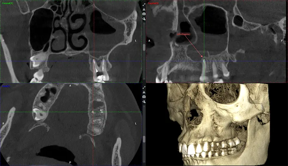 Dental treatment at Dr. G Dental Studio Miami